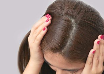 9 Ways To Get Rid Of Dandruff