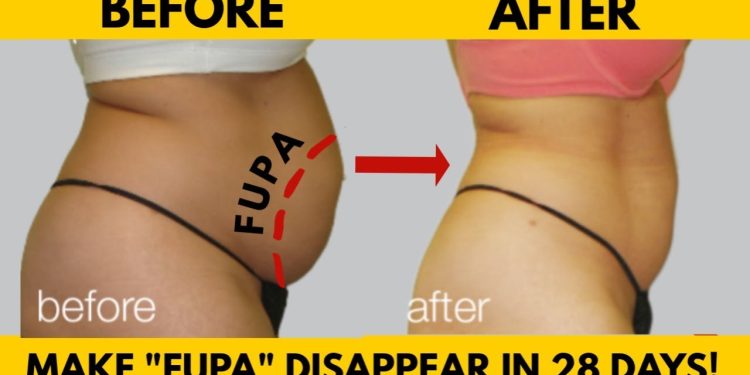 What is FUPA? | How to Get Rid of FUPA?