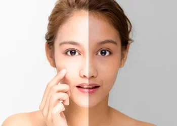 10 Best Skin Whitening Creams in India (2023)