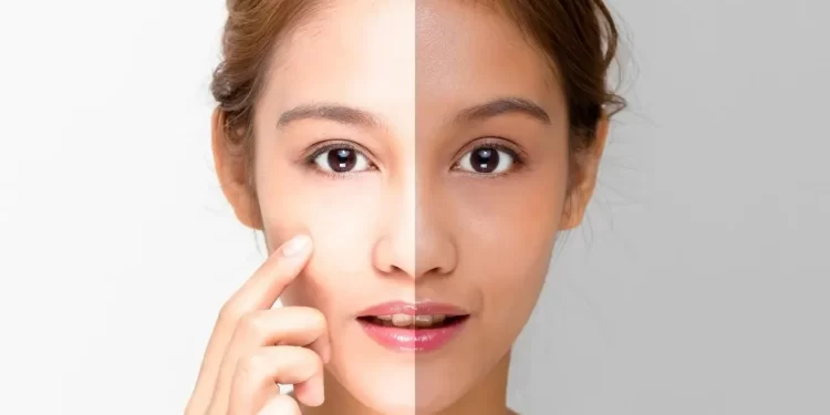 10 Best Skin Whitening Creams in India (2023)